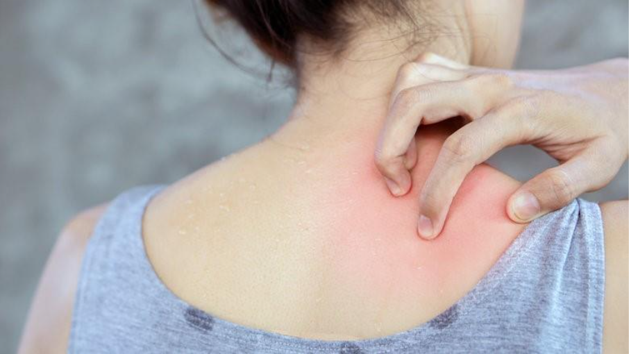 Wat zijn allergien precies